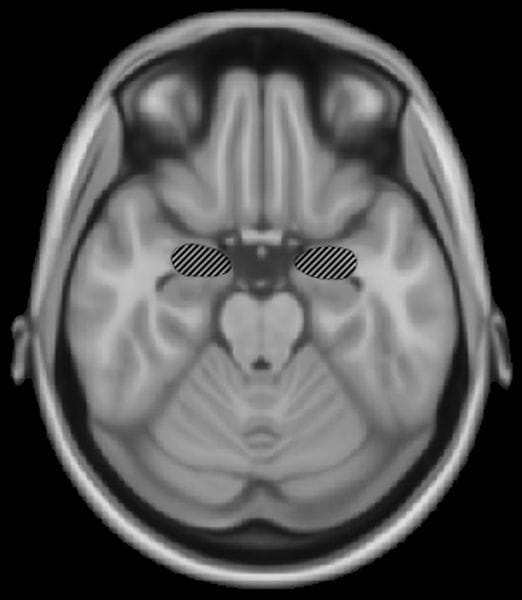 An image showing the location of the amygdala