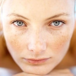 Girl with clear skin and freckles